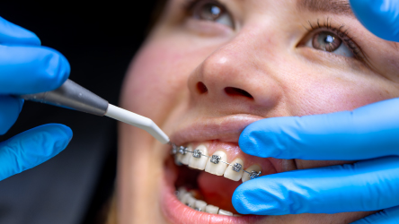 Advanced Endodontics